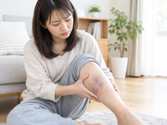ふくらはぎの肉離れを放置して悪化したイメージ